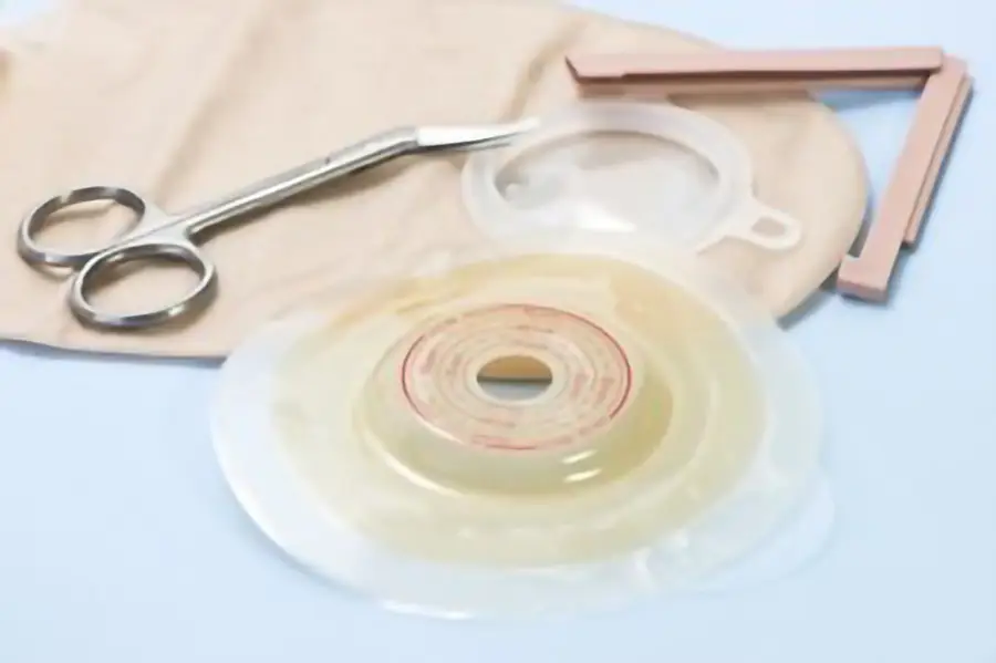 Emplacement des stomies