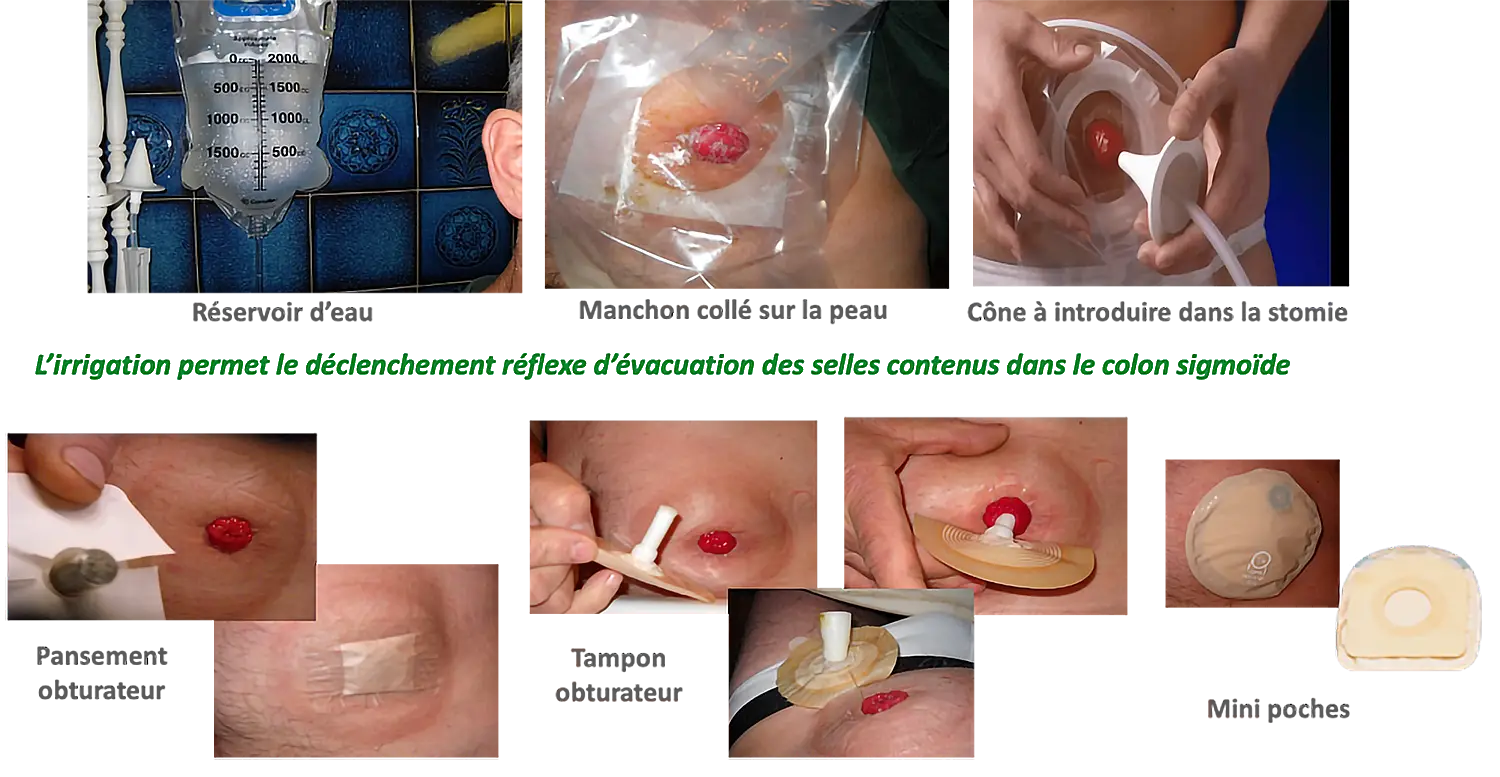 Poches 1 ou 2 pièces